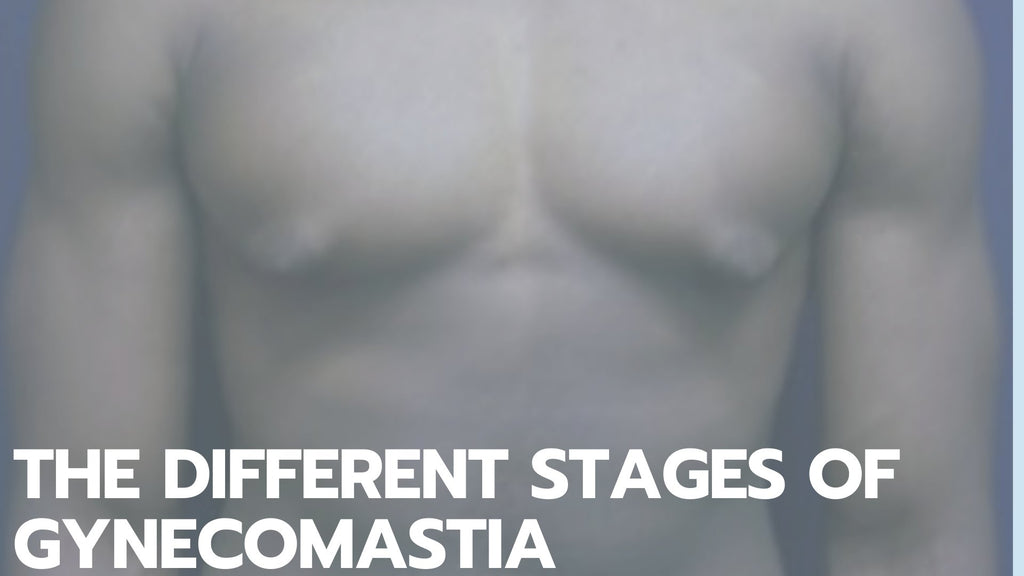 The Different Stages of Gynecomastia